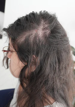 Hair Growth Routine | For Women 18 Hair Growth Routine | For Women